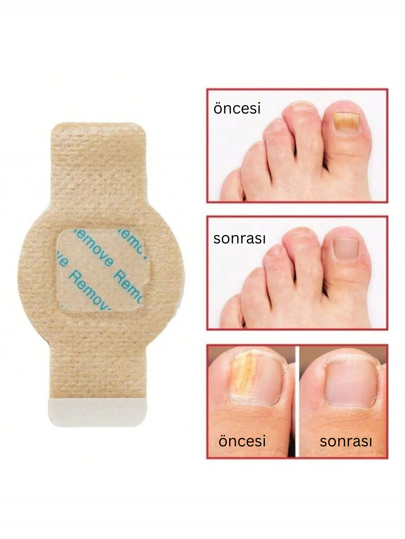 CUREVIA® Tırnak Mantarı İçin Patch – 21’li Paket