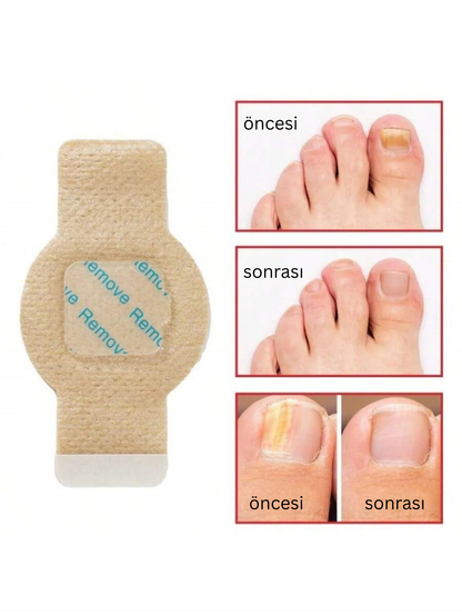 CUREVIA® Tırnak Mantarı İçin Patch – 21’li Paket